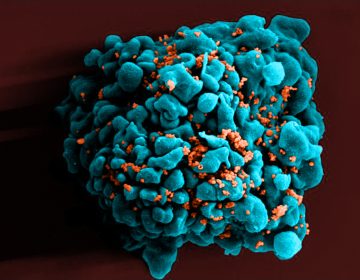 A color-enhanced scanning electron micrograph shows HIV particles (orange) infecting a T cell, one of the white blood cells that play a central role in the immune system. (Courtesy of Science Source) 