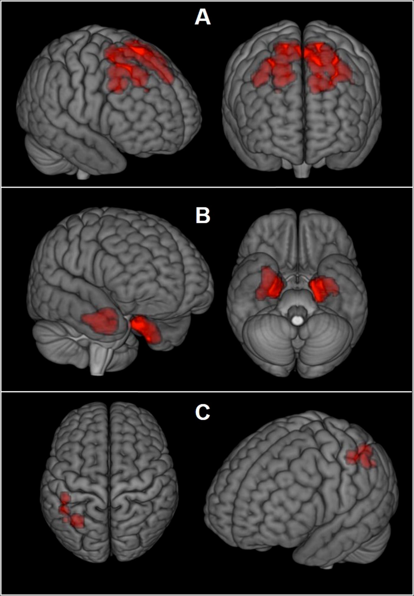 brain-scans-may-reveal-concussion-damage-in-living-athletes-whyy