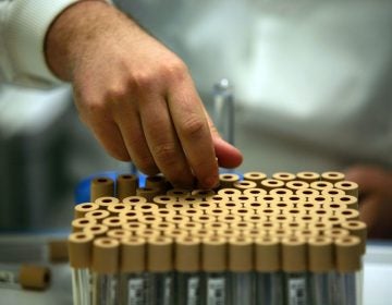 Researchers looked for genetic variants linked to sexual behavior in new genetic research that analyzed DNA from donated blood samples from nearly half a million middle-aged people from Britain who participated in a project called the UK Biobank. (Christopher Furlong/Getty Images)
