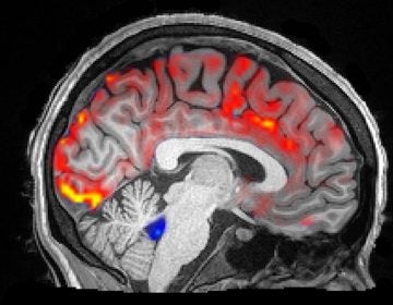 During deep sleep, waves of cerebrospinal fluid (blue) coincide with temporary decreases in blood flow (red). Less blood in the brain means more room for the fluid to carry away toxins, including those associated with Alzheimer’s disease. (Fultz et al., 2019)