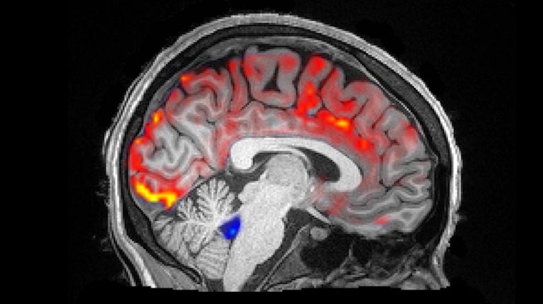 During deep sleep, waves of cerebrospinal fluid (blue) coincide with temporary decreases in blood flow (red). Less blood in the brain means more room for the fluid to carry away toxins, including those associated with Alzheimer’s disease. (Fultz et al., 2019)