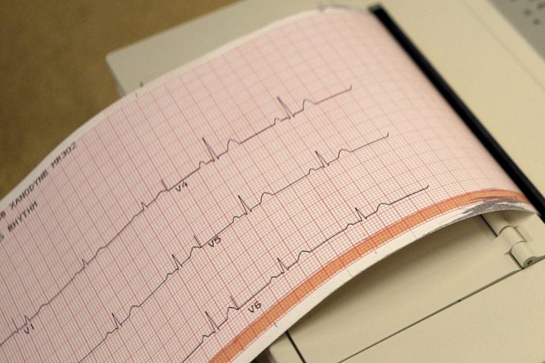 This May 26, 2009 file photo shows a printout from an electrocardiogram machine in Missouri. Doctors are reporting that novel drugs may offer fresh ways to reduce heart risks beyond the usual medicines to lower cholesterol and blood pressure. One new study found that heart attack survivors benefited from a medicine long used to treat gout. Gene-targeting medicines also showed promise in studies discussed Monday, Nov. 18, 2019,  at an American Heart Association conference in Philadelphia. (Jeff Roberson/AP Photo)