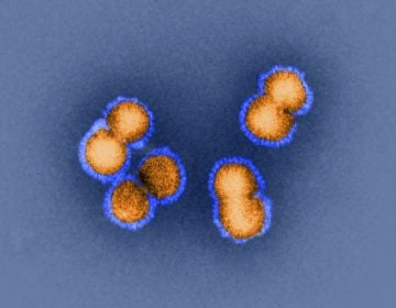 H5N1 bird flu virus is the sort of virus under discussion this week in Bethesda, Md. How animal viruses can acquire the ability to jump into humans and quickly move from person to person is exactly the question that some researchers are trying to answer by manipulating pathogens in the lab. (SPL/Dr. Klaus Boller/Science Source)