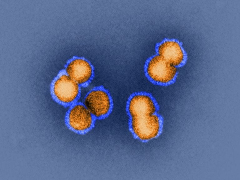 H5N1 bird flu virus is the sort of virus under discussion this week in Bethesda, Md. How animal viruses can acquire the ability to jump into humans and quickly move from person to person is exactly the question that some researchers are trying to answer by manipulating pathogens in the lab. (SPL/Dr. Klaus Boller/Science Source)