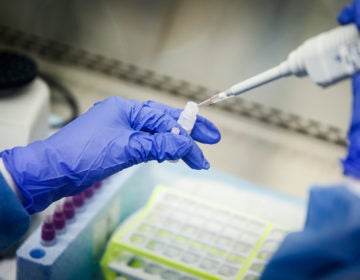 A laboratory technician prepares COVID-19 patient samples for semi-automatic testing at Northwell Health Labs, Wednesday, March 11, 2020, in Lake Success, N.Y. (John Minchillo/AP Photo)