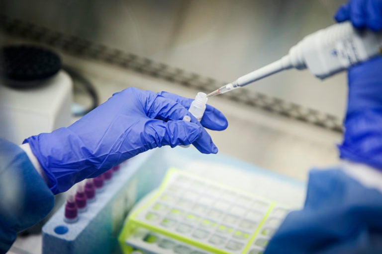 A laboratory technician prepares COVID-19 patient samples for semi-automatic testing at Northwell Health Labs, Wednesday, March 11, 2020, in Lake Success, N.Y. (John Minchillo/AP Photo)