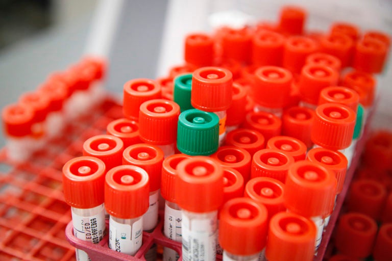 A laboratory technician prepares COVID-19 patient samples for semi-automatic testing at Northwell Health Labs, Wednesday, March 11, 2020, in Lake Success, N.Y. The US Food and Drug Administration has approved faster testing protocols as the viral outbreak continues to spread worldwide. For most people, the new coronavirus causes only mild or moderate symptoms. For some it can cause more severe illness. (AP Photo/John Minchillo)