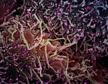 This image made by a scanning electron micrograph shows SARS-COV-2 virus particles (colorized pink) from a patient sample. There are various studies looking at changes to the virus genome — and the possible impact on how the virus affects humans. (NIAID/NIH)