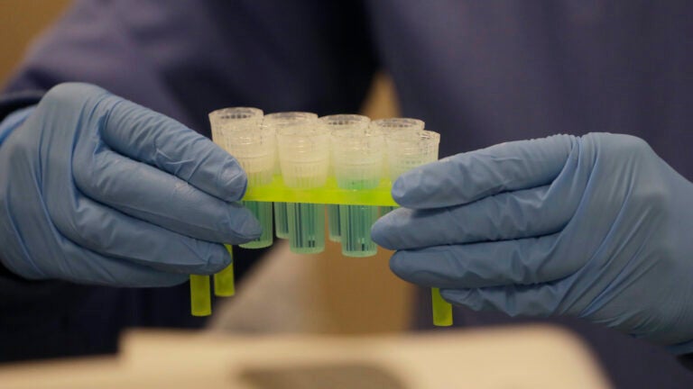 In this April 3, 2020, photo, a technician holds blue preservation solution in a clean room where saliva collection devices are assembled at Spectrum DNA in Draper, Utah. The company has developed a test kit to detect the coronavirus in patients' saliva. (AP Photo/Rick Bowmer)