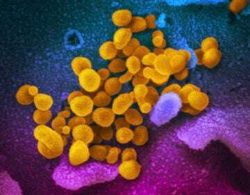 This undated electron microscope image made available by the U.S. National Institutes of Health in February 2020 shows the Novel Coronavirus SARS-CoV-2, yellow, emerging from the surface of cells, blue/pink, cultured in the lab. (NIAID-RML via AP, File)