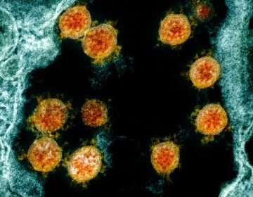 Internationally, scientists now have on file the genomes of more than 47,000 different samples of the virus that causes COVID-19 — up from just one in January. Here's a transmission electron micrograph of SARS-CoV-2 virus particles (orange) isolated from a patient.
(National Institute of Allergy and Infectious Diseases/National Institutes of Health)