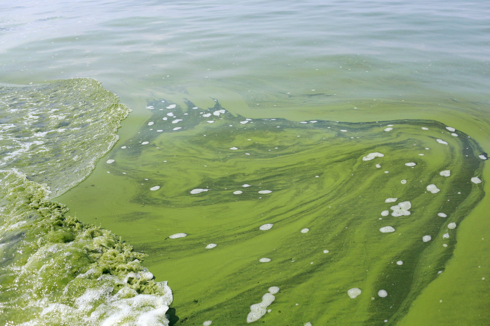 Blue-green algae: toxic levels found in South Jersey pond - WHYY