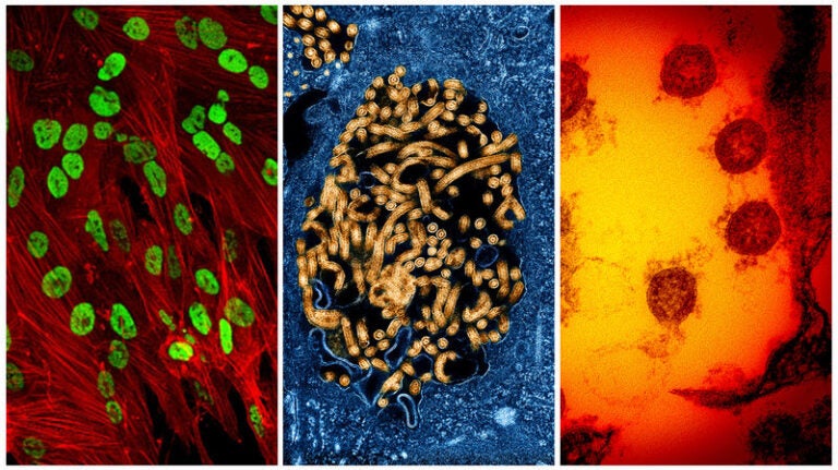 From left: Colorized transmission electron micrograph of herpes simplex virus, Ebola virus and SARS-CoV-2 virus particles. Researchers now believe the coronavirus is likely to be a continuing threat until a vaccine is developed.
NIAID; NIH; NIH