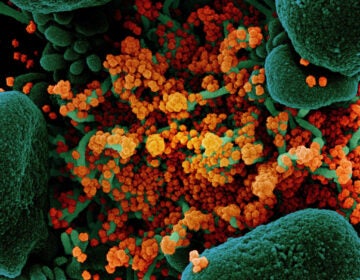 A colorized scanning electron micrograph of a cell (green) heavily infected with particles (orange) from the virus that causes COVID-19, isolated from a patient sample. (NIAID)