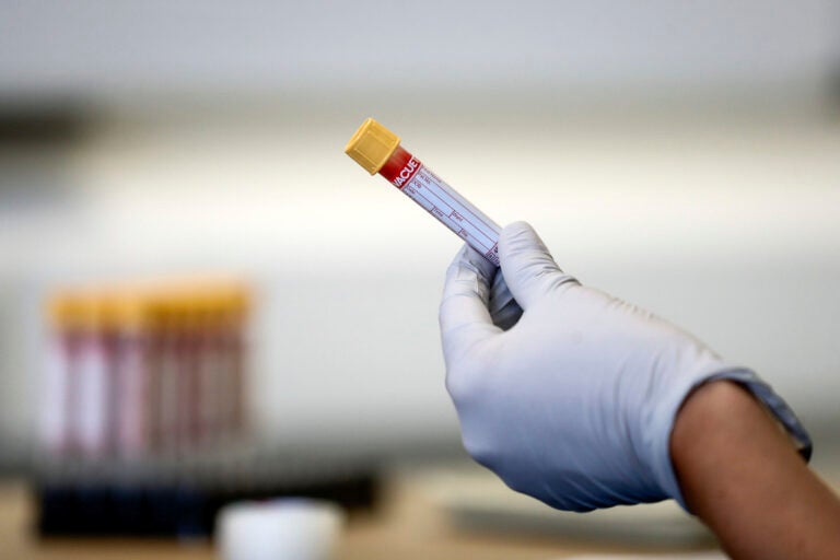 An antibody test for the coronavirus can indicate whether someone has been infected, but it's just one measure of immunity, researchers say. How robust that immunity is and how long it lasts are still open questions. (Simon Dawson/AP Photo)