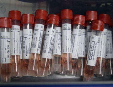 Specimens collected from multiple people can be combined into one batch to test for the coronavirus. A negative result would clear all the specimens.
