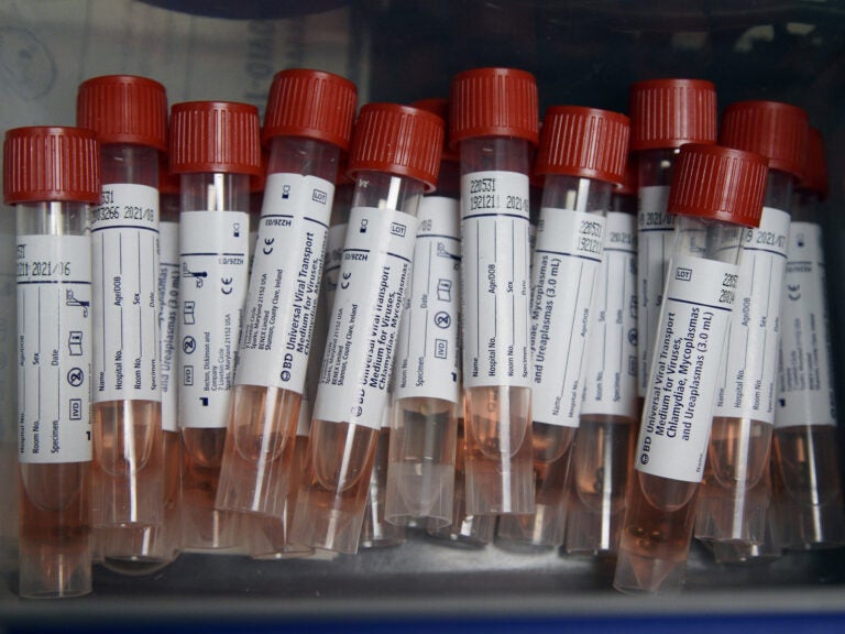 Specimens collected from multiple people can be combined into one batch to test for the coronavirus. A negative result would clear all the specimens.