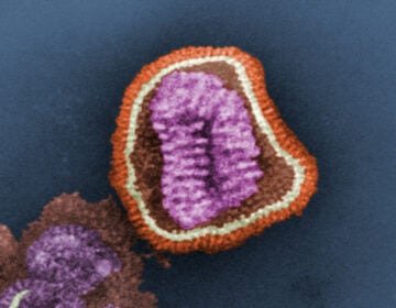 The influenza virus. (Frederick Murphy/CDC)