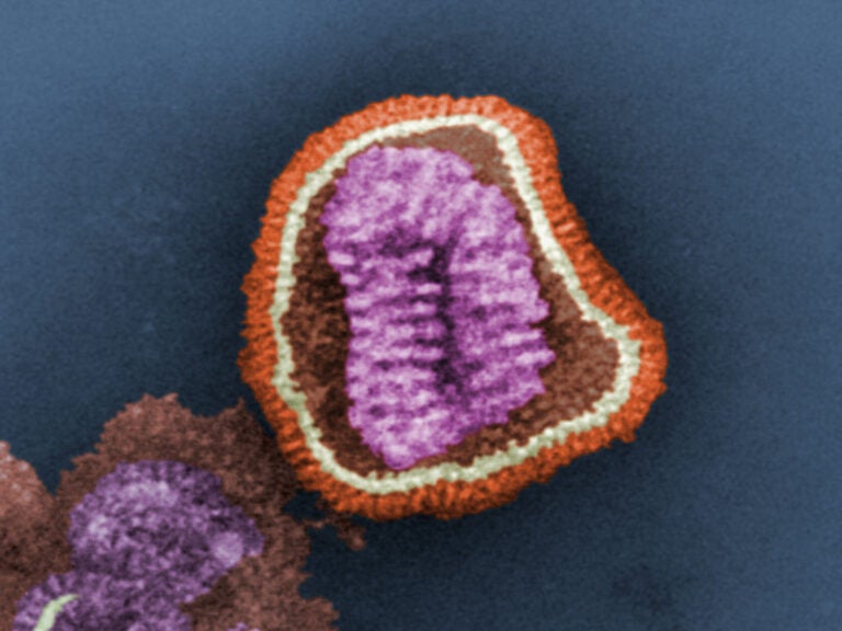 The influenza virus. (Frederick Murphy/CDC)