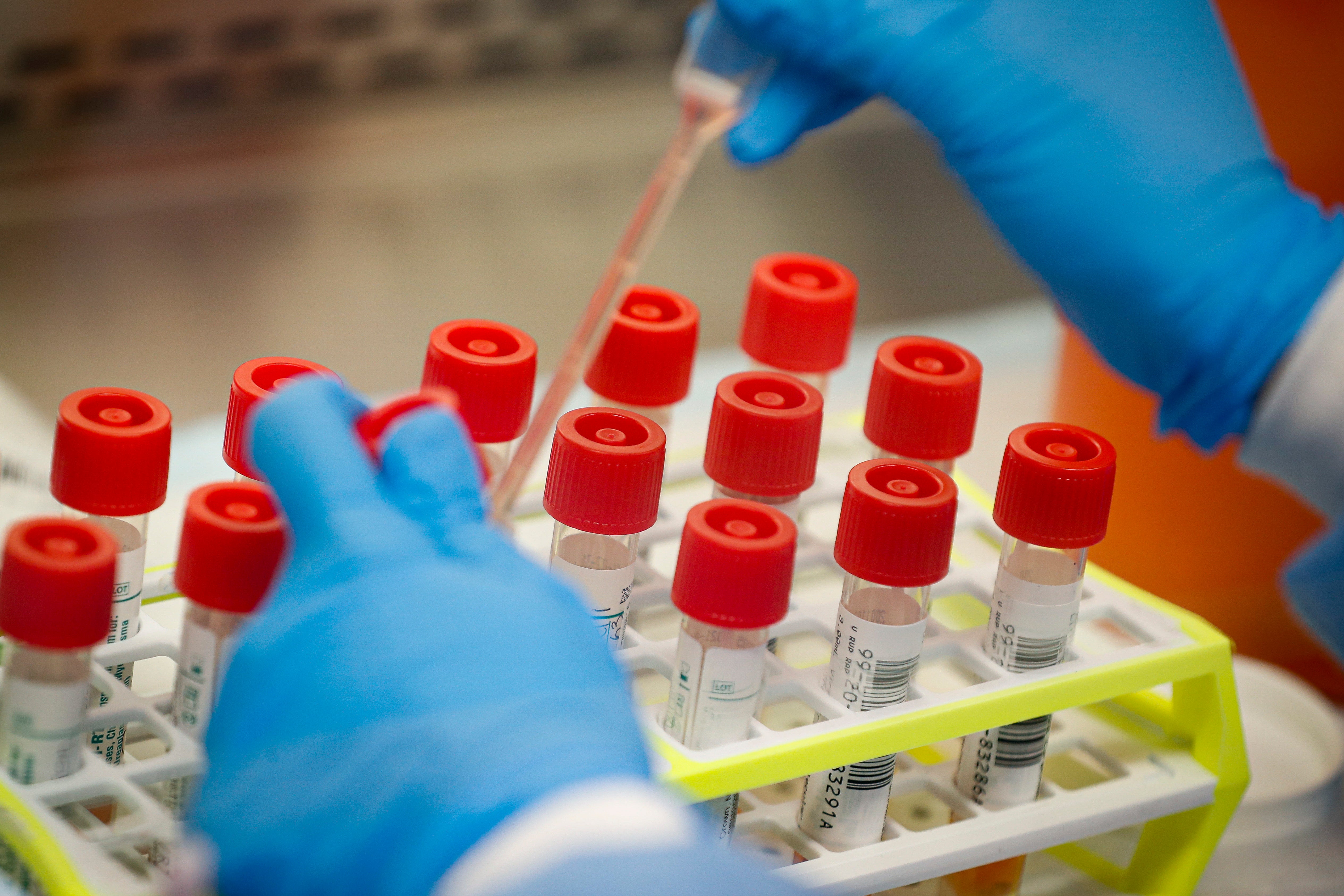 A technician prepares coronavirus test samples on New York's Long Island. The head of New York City's public labs said fighting the virus without a test was like building a house with a saw but no hammer.