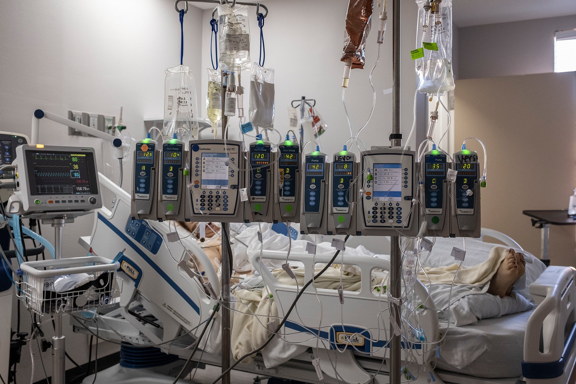 IV pumps and electrocardiogram machines are seen in a patient's room