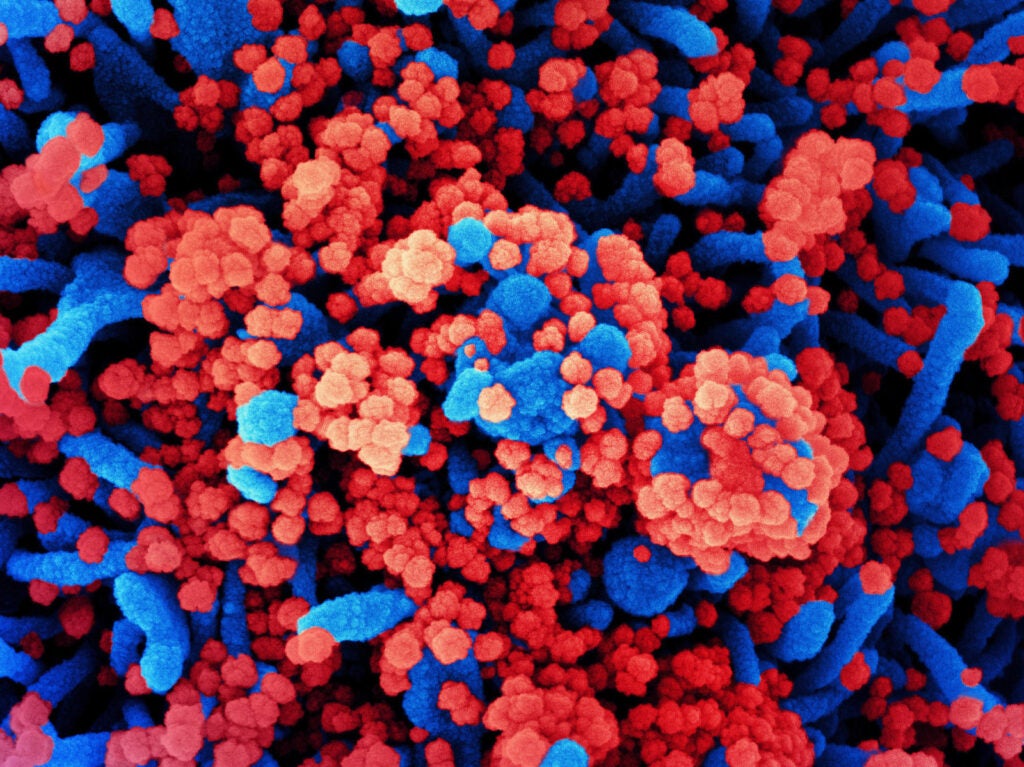 SARS-CoV-2 virus particles, shown in red, have heavily infected a cell in this colorized scanning electron micrograph.