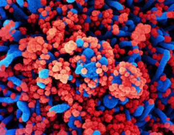 SARS-CoV-2 virus particles, shown in red, have heavily infected a cell in this colorized scanning electron micrograph.