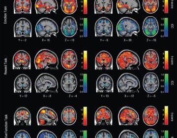 A series of brain scan images against a black background. Brain scans showing MRI mapping for 3 tasks across 2 different days. Warm colors show how the results hold up in groups. Cool colors show how results are less reliable person to person. Photo credit: Annchen Knodt/Duke University.