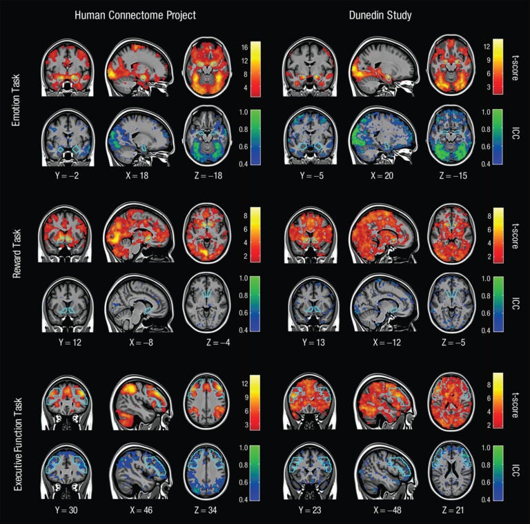 A series of brain scan images against a black background. Brain scans showing MRI mapping for 3 tasks across 2 different days. Warm colors show how the results hold up in groups. Cool colors show how results are less reliable person to person. Photo credit: Annchen Knodt/Duke University.