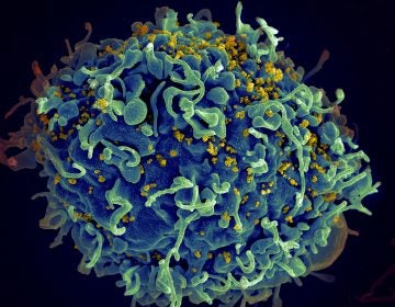 An electron microscope image shows a human T cell under attack by HIV