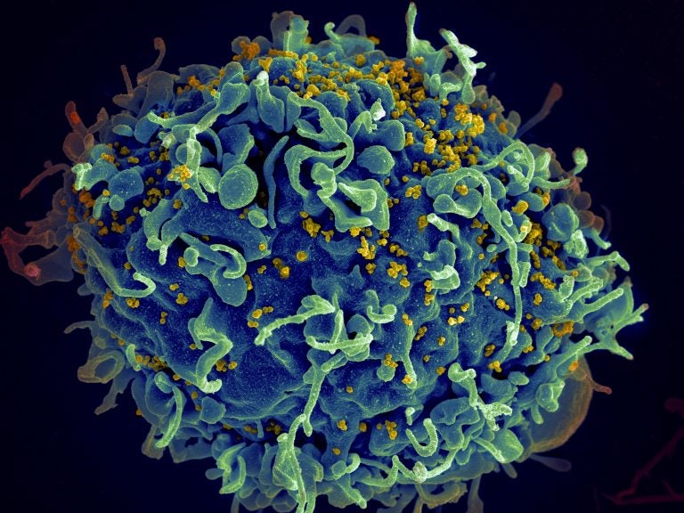 An electron microscope image shows a human T cell under attack by HIV