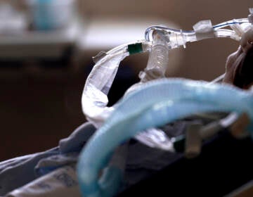 A patient with COVID-19 on breathing support lies in a bed in an intensive care unit