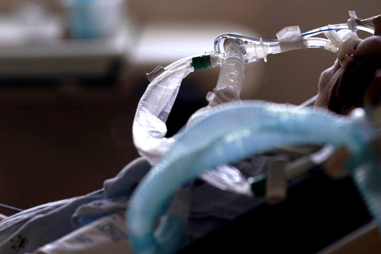 A patient with COVID-19 on breathing support lies in a bed in an intensive care unit