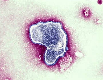 At the moment there is little data available on the impact of contracting COVID-19 and the respiratory syncytial virus (pictured), and whether together they can make a person sicker. But health officials worry it could put young patients — who are not eligible for the coronavirus vaccine — at greater risk. (BSIP/UIG Via Getty Images/Universal Images Group via Getty)