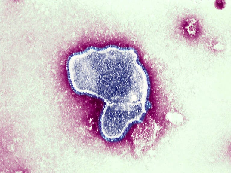 At the moment there is little data available on the impact of contracting COVID-19 and the respiratory syncytial virus (pictured), and whether together they can make a person sicker. But health officials worry it could put young patients — who are not eligible for the coronavirus vaccine — at greater risk. (BSIP/UIG Via Getty Images/Universal Images Group via Getty)