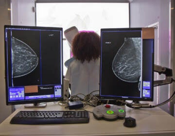 Staff of Penn Medicine’s mobile mammography unit demonstrate how patients receive a mammogram on Oct. 22, 2021 in Philadelphia