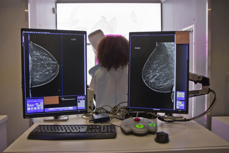 2021 10 22 k paynter mobile breast cancer screening-4 Staff of Penn Medicine’s mobile mammography unit demonstrate how patients receive a mammogram on Oct. 22, 2021 in Philadelphia