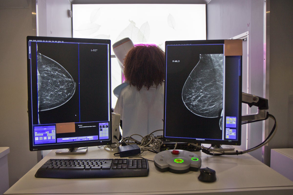 Study finds Delaware breast cancer hotspots tied to low screening, aggressive tumors
