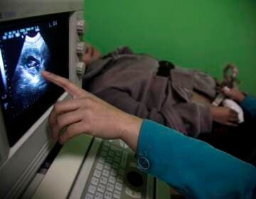 A doctor performs an ultrasound scan. It’s possible to prevent congenital syphilis from being passed to a fetus during pregnancy, yet rates of congenital syphilis have been rising at alarming rates. (AP Photo/Ng Han Guan)