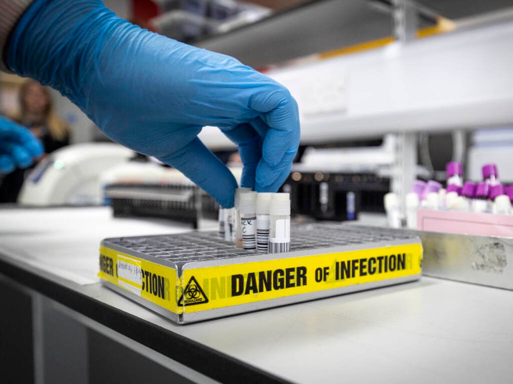 Clinical support technician Douglas Condie extracts viruses from swab samples