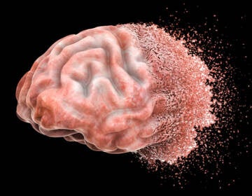 A rendering of a brain breaking apart into small pieces