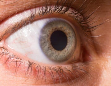 Close up on dilated pupil. (Courtesy of Big Stock Image)