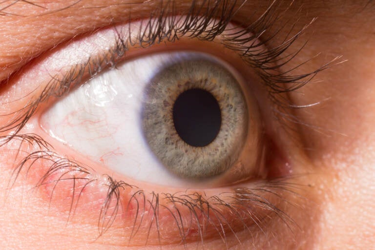 Close up on dilated pupil. (Courtesy of Big Stock Image)