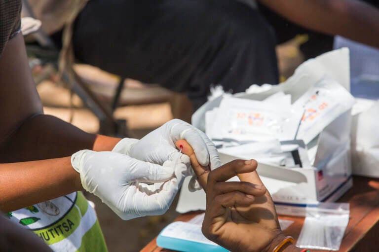 Testing blood for malaria at a Doctors Without Borders clinic in Malawi. (Ashley Cooper/Getty Images)