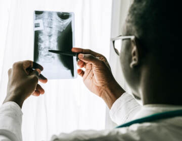 A doctor looking at an x-ray