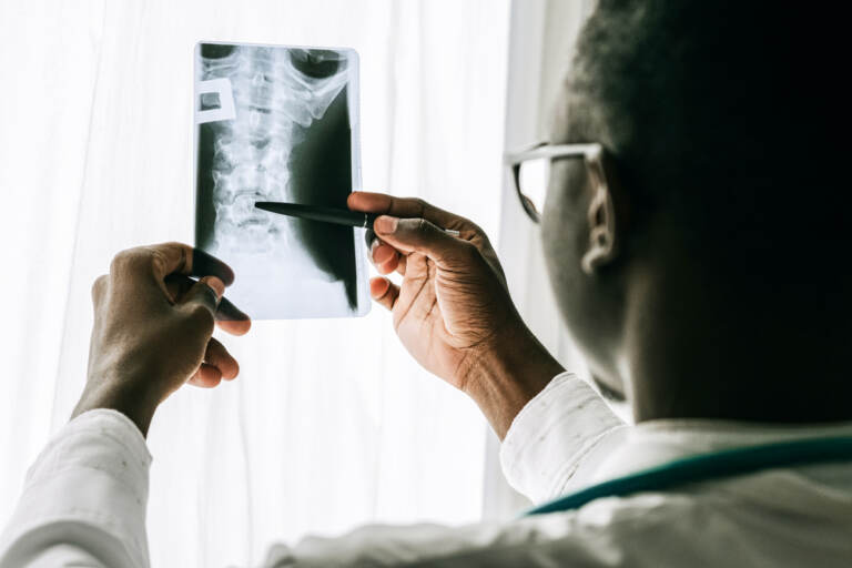 A doctor looking at an x-ray