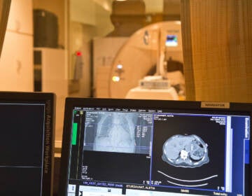 A PET scan in process at Adler Imaging. (Kimberly Paynter/WHYY)