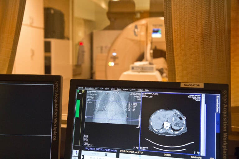 A PET scan in process at Adler Imaging. (Kimberly Paynter/WHYY)