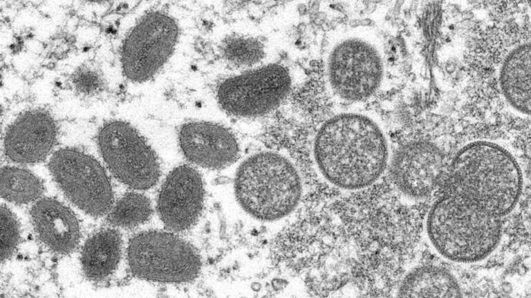 An electron microscope image shows monkeypox virus particles.