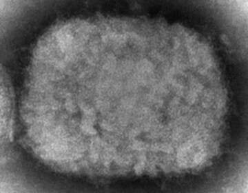 A 2003 electron microscope image shows a monkeypox virion.